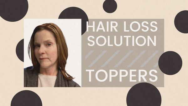 Hair Loss Solution: Toppers